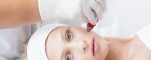Dermapen in Bodrum