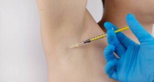 Armpit Botox Treatment in Bodrum
