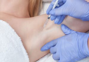 Botox for Excessive Sweating in Bodrum