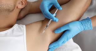 Botox for Excessive Sweating in Bodrum