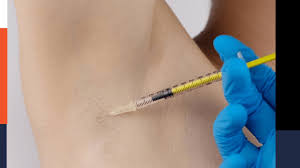 Botox for Excessive Sweating in Bodrum