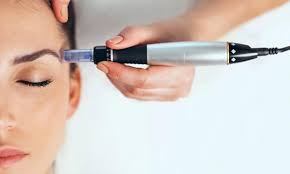 Dermapen in Bodrum Before After