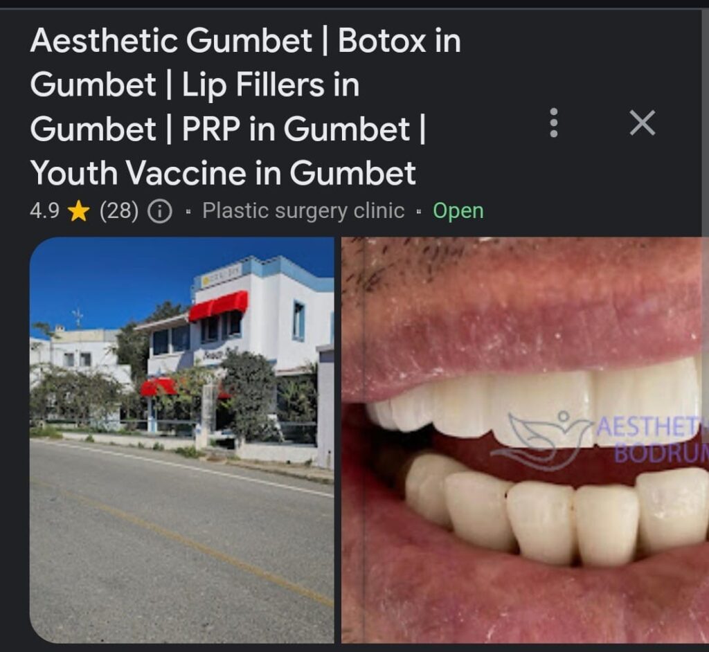 Botox Reviews Bodrum