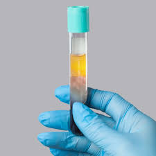 PRP Hair Treatment Bodrum