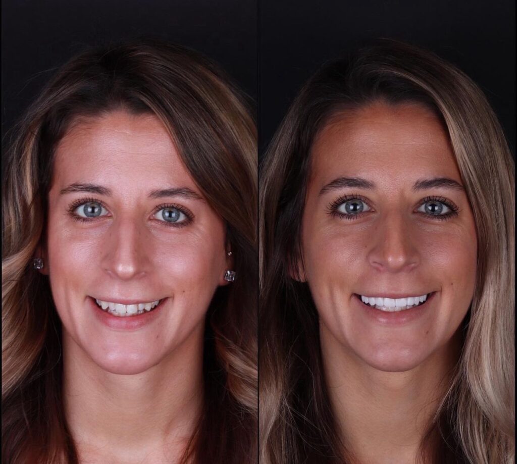 Comprehensive Guide to Dental Treatments in Bodrum