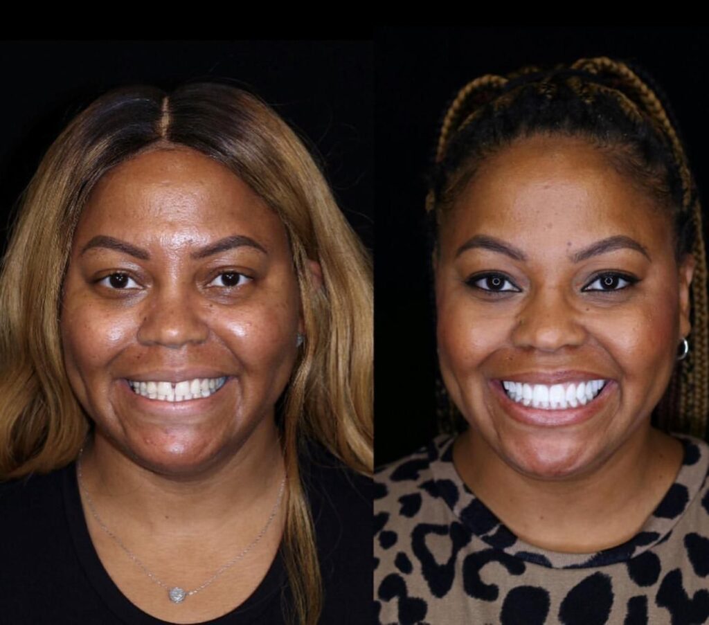 https://www.dentistgumbet.com/contact/
